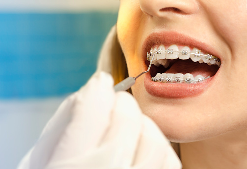 Orthodontic Services in Moberly, MO